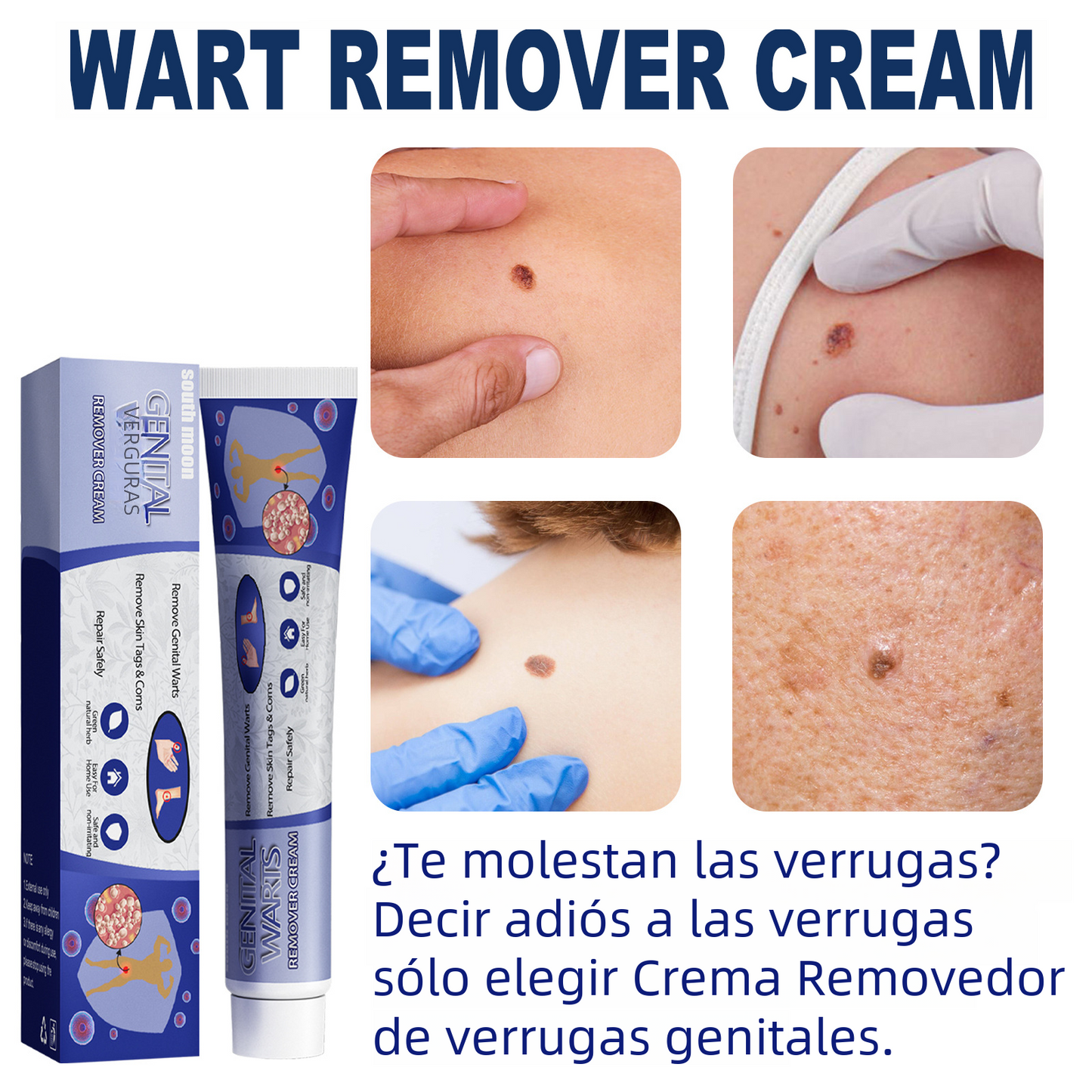 South Moon Wart Removal Cream for Skin Repair