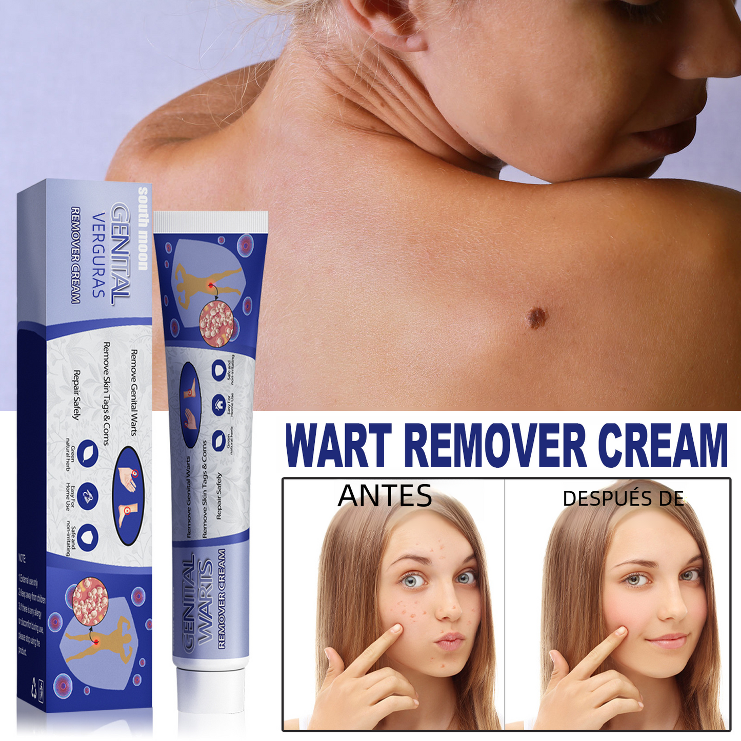 South Moon Wart Removal Cream for Skin Repair